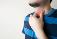 علاج بحة الصوت بسبب البرد