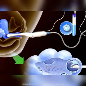 جودة وعدد البويضات الناتجة عن التنشيط بحقن جونابيور